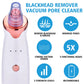 Vacuum Suction Blackhead Remover