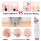 Vacuum Suction Blackhead Remover