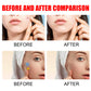 Pimple Patches,Pimple Patches For Face, Hydrocolloid Acne Patches, Cute Star Stickers Hydrocolloid Acne Pimple Patch For Covering Zits And Blemishes